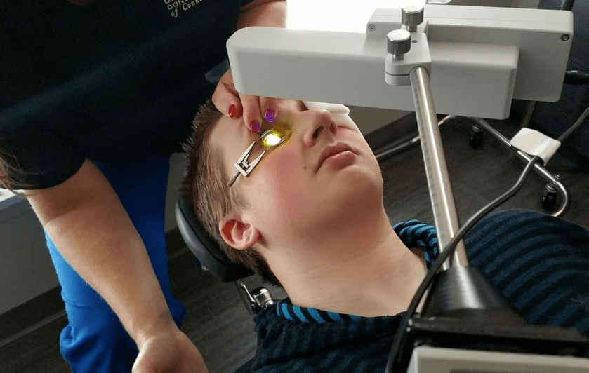 Crosslinking effectively eliminates keratoconus at the beginning of development